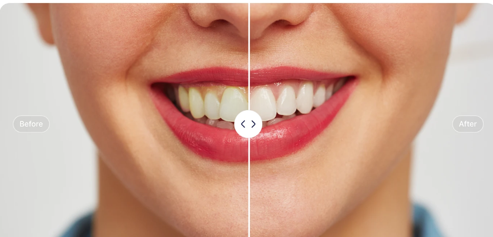 Before & After