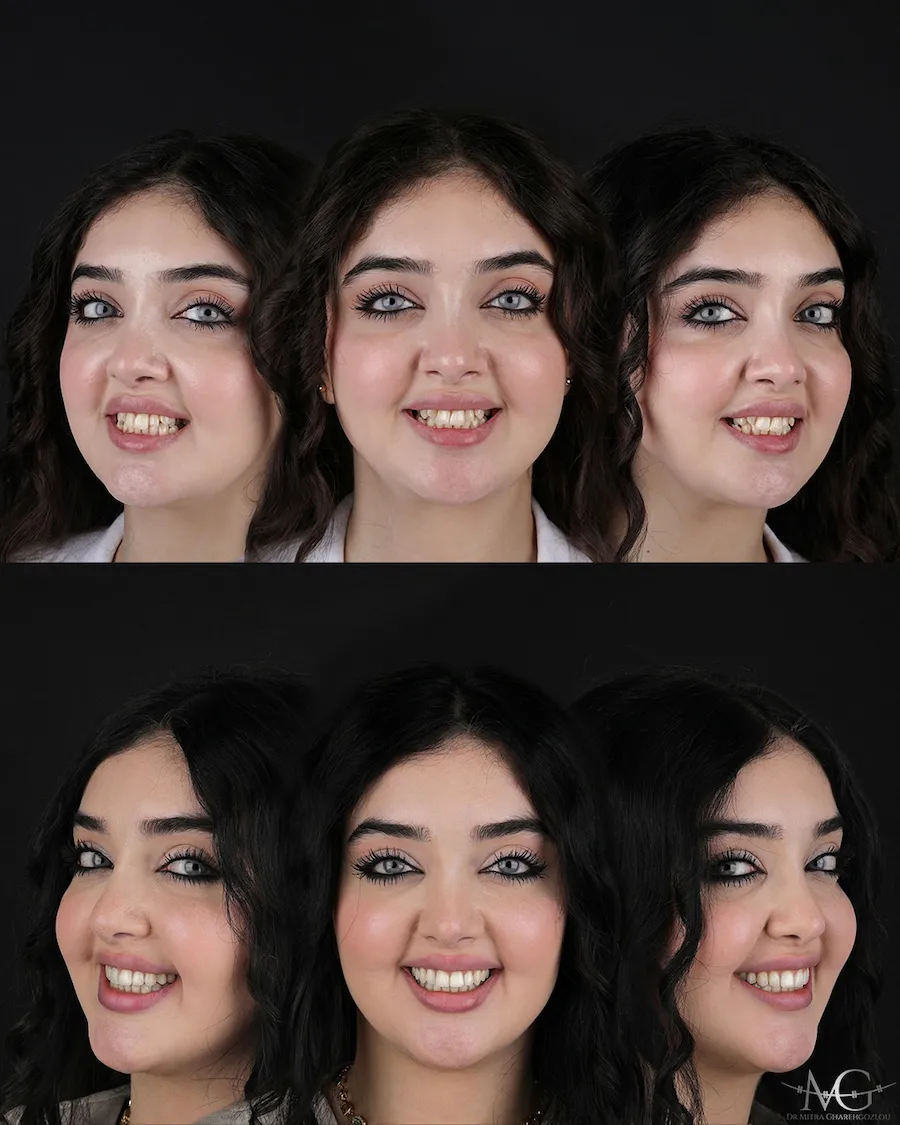 ارتودنسی قبل و بعد