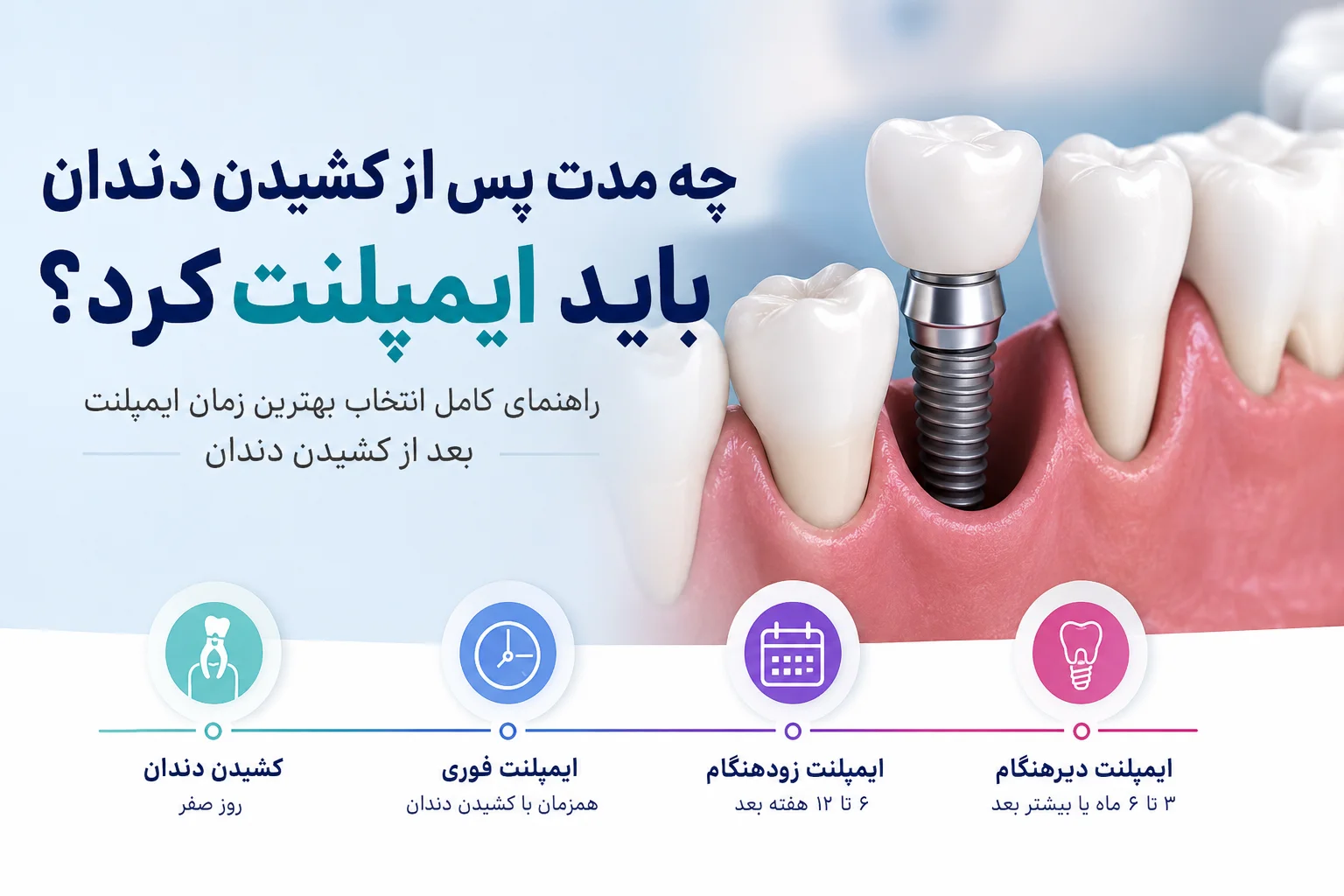 چه مدت پس از کشیدن دندان باید ایمپلنت کرد