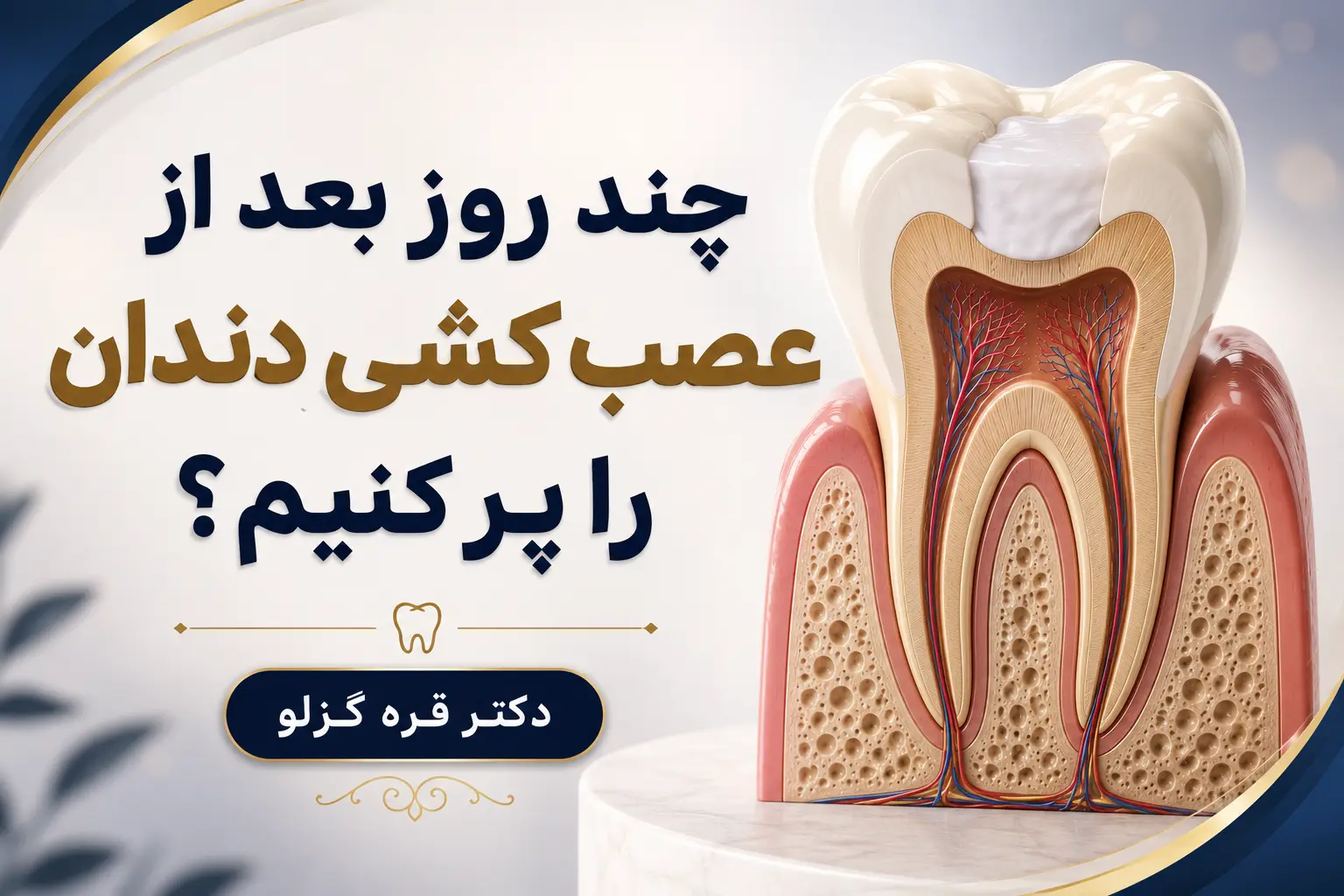 چند روز بعد از عصب کشی دندان را پر کنیم؟
