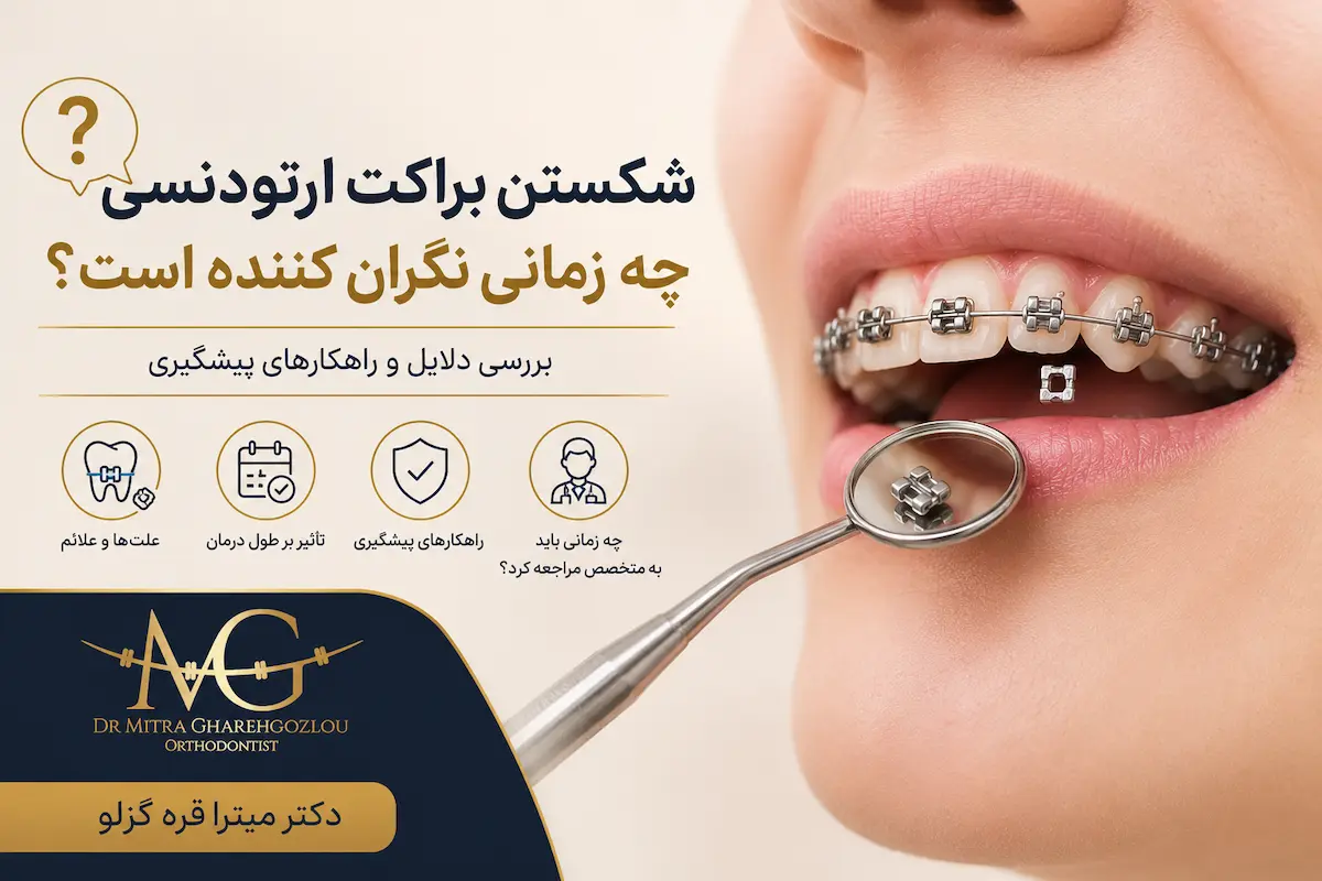 شکستن براکت ارتودنسی چه زمانی نگران کننده است؟ بررسی دلایل و راهکارهای پیشگیری