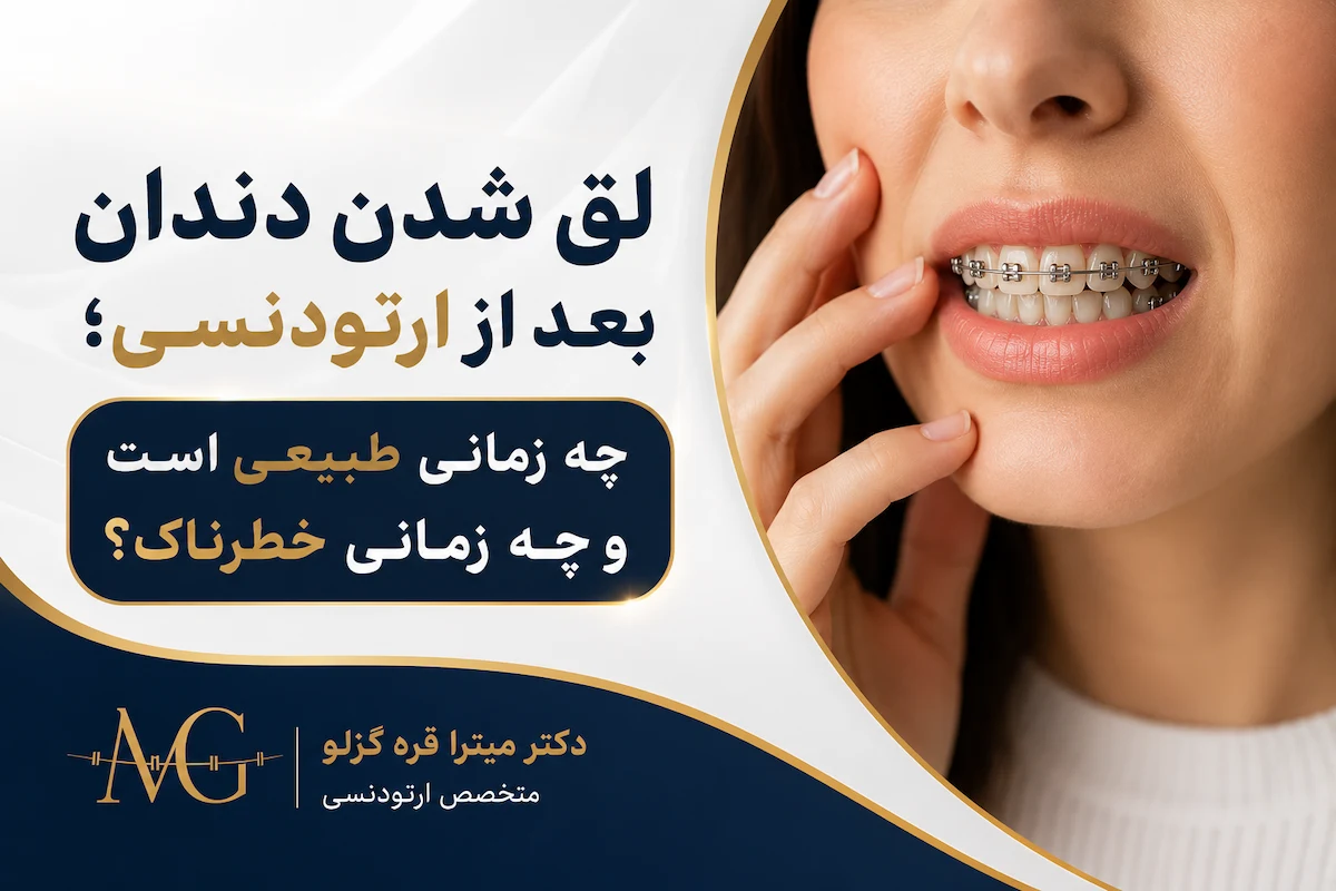لق شدن دندان بعد از ارتودنسی؛ چه زمانی طبیعی است و چه زمانی خطرناک؟