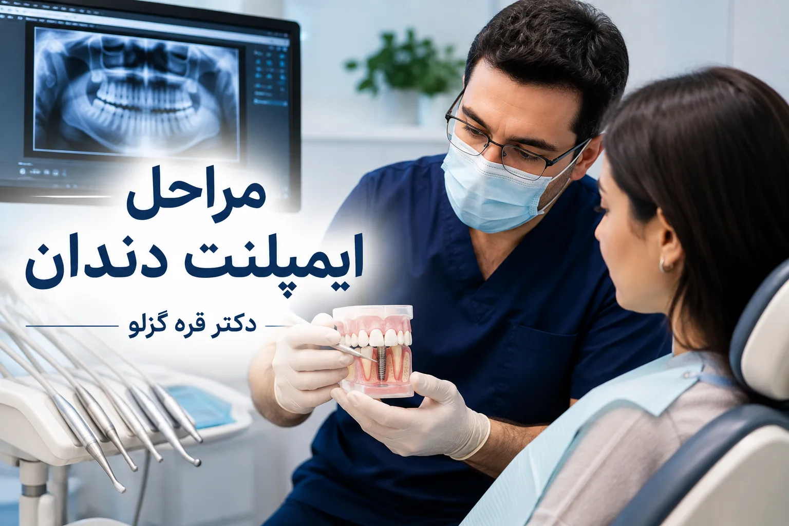 مراحل ایمپلنت دندان؛ صفر تا صد مراحل کاشت ایمپلنت
