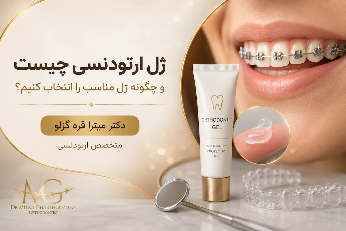 ژل ارتودنسی برای مراقبت از زخم و تحریک دهان