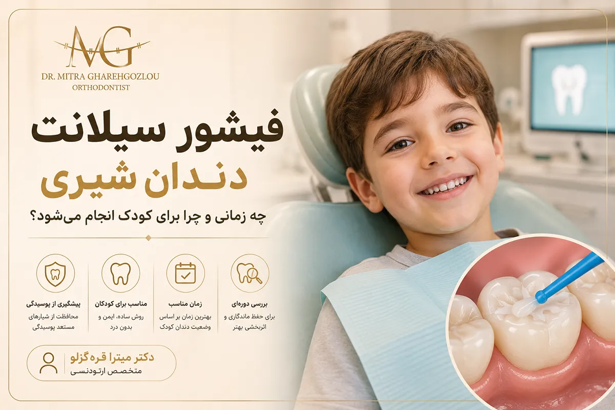 فیشور سیلانت دندان شیری؛ چه زمانی و چرا انجام می‌شود؟