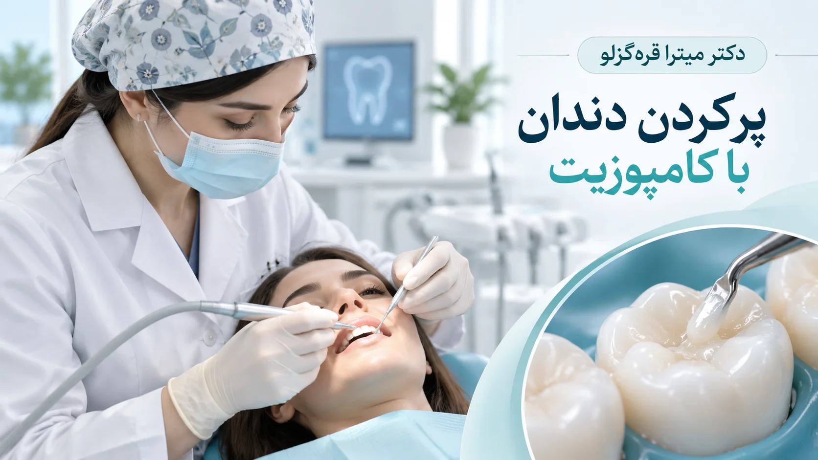 پر کردن دندان با کامپوزیت؛ هزینه، عمر و مراحل