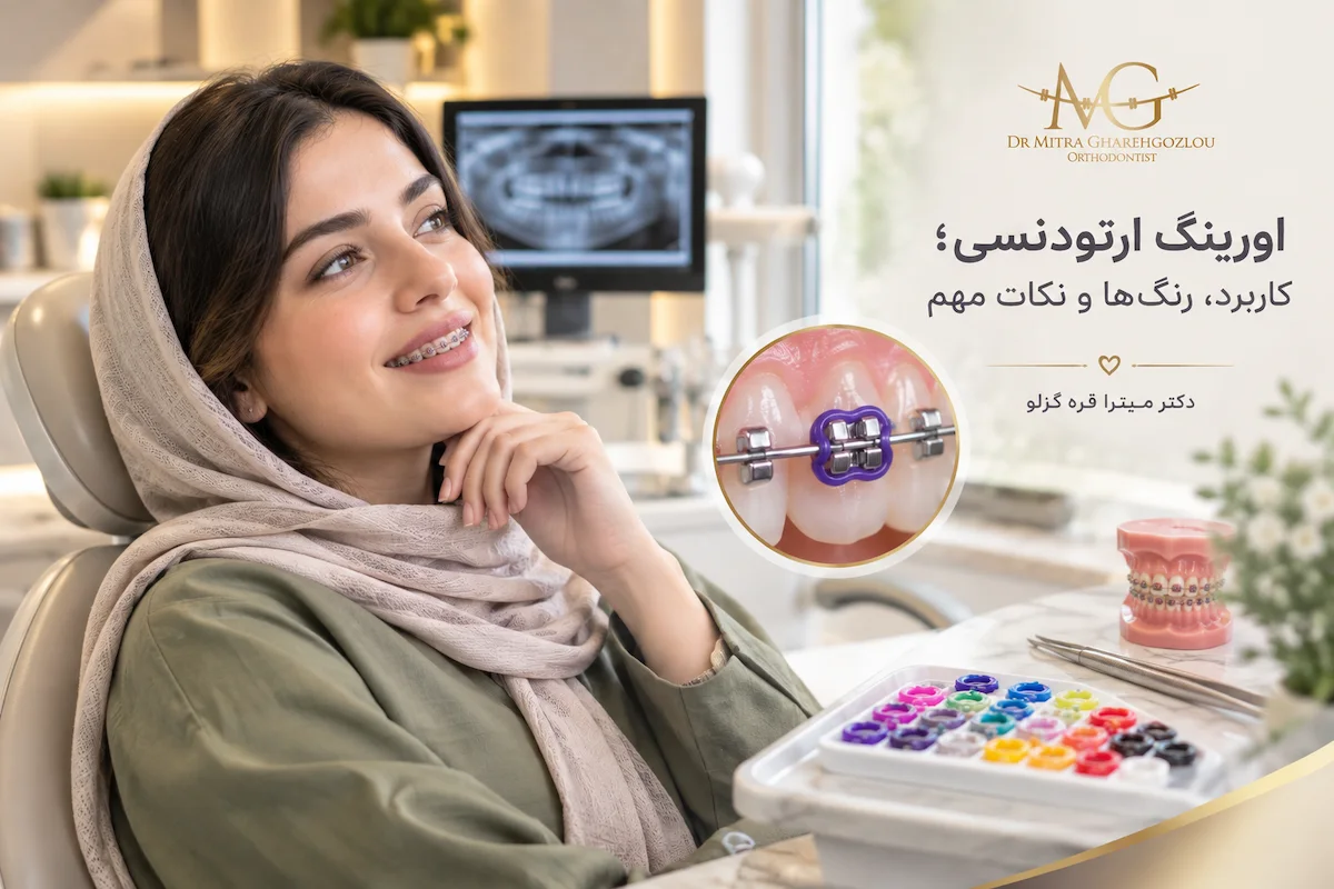اورینگ ارتودنسی چیست و چه کاری انجام میدهد؟