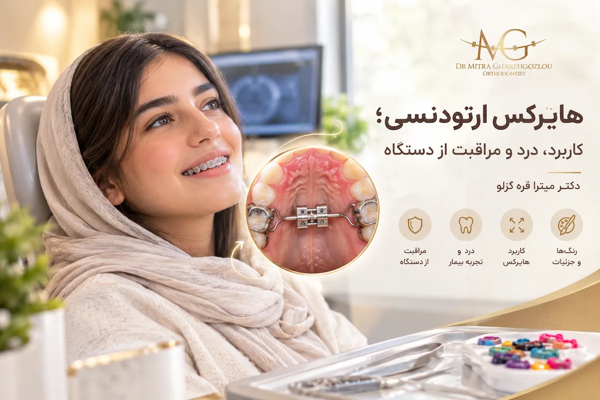 هایرکس ارتودنسی چیست و چه کاربردی دارد؟