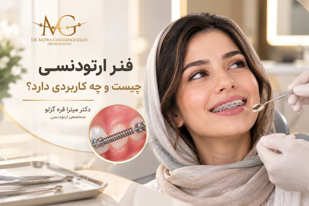 فنر ارتودنسی چیست و چه کاربردی دارد؟
