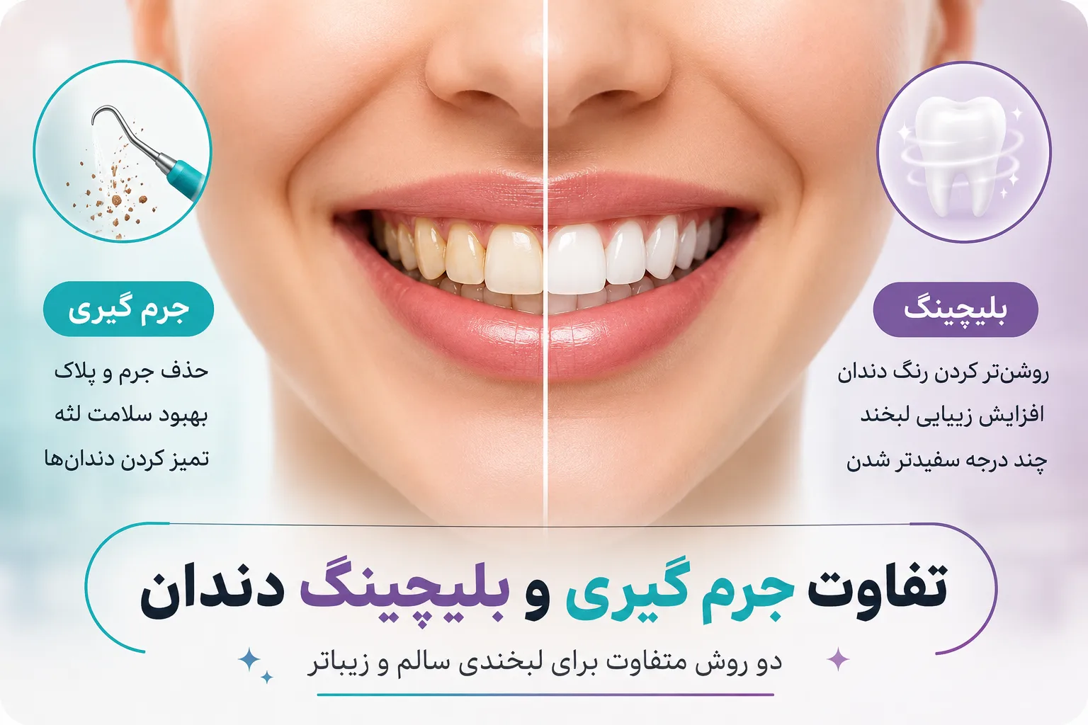 تفاوت بلیچینگ و جرمگیری دندان در یک نگاه