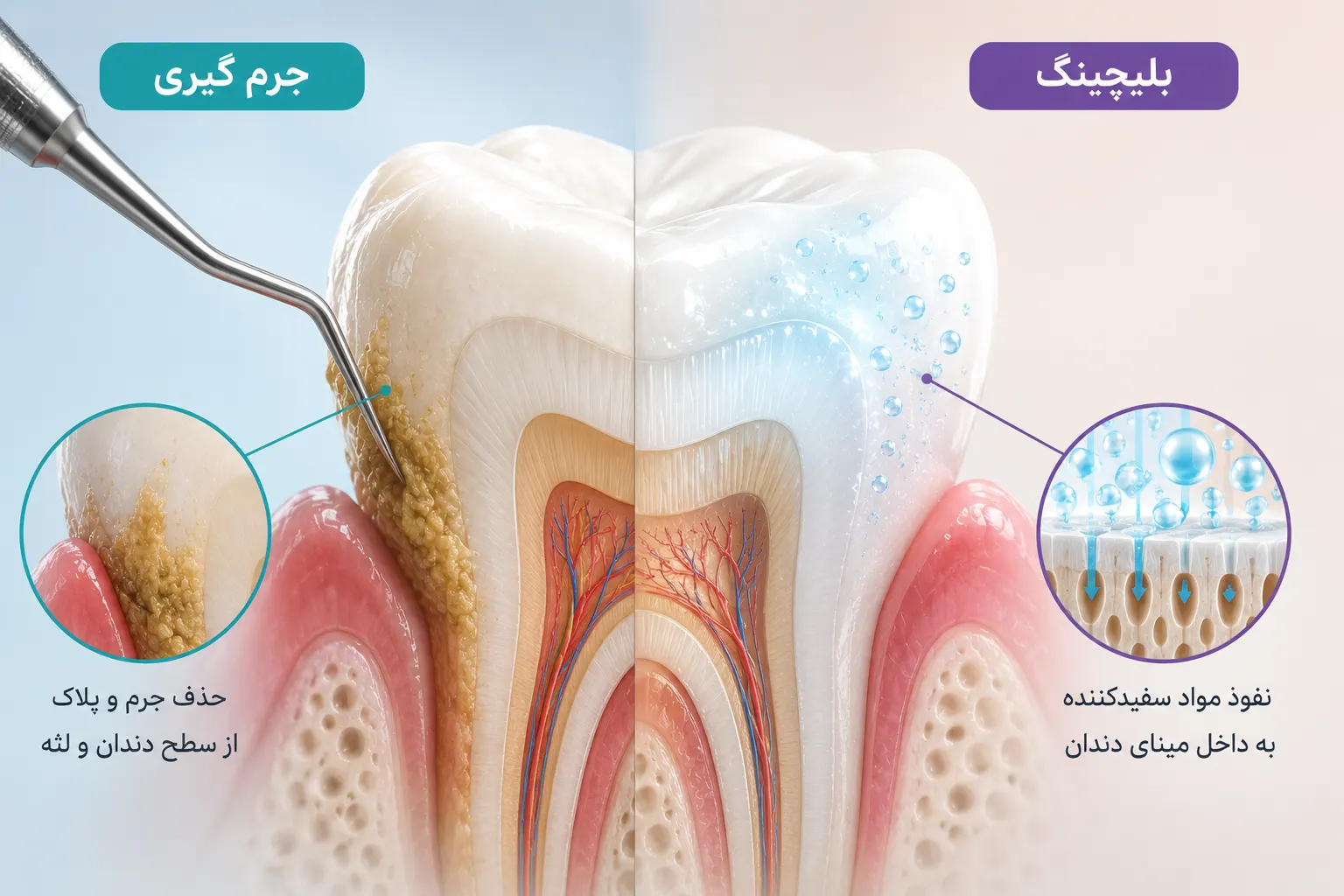 جرمگیری بهتر است یا بلیچینگ