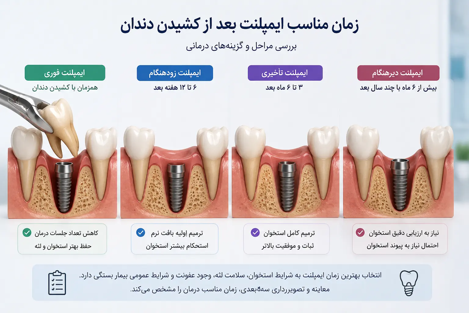 زمان مناسب ایمپلنت بعد از کشیدن دندان