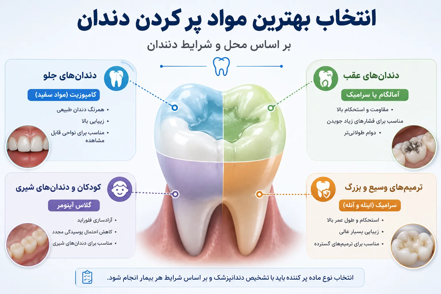 بهترین مواد پر کردن دندان