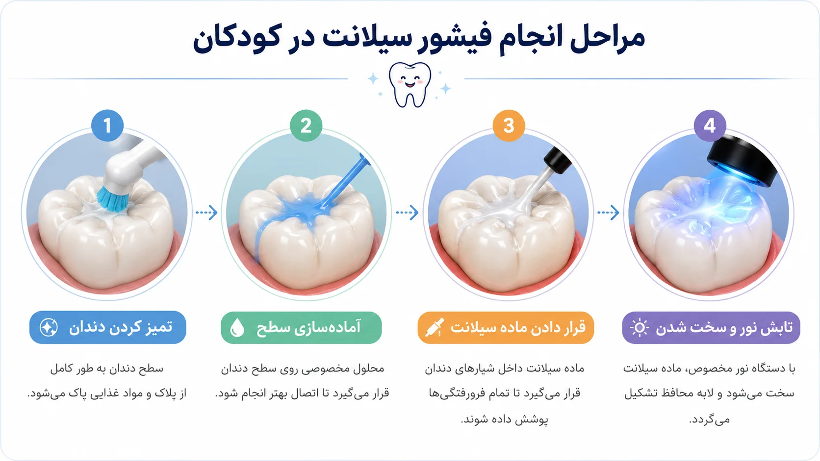 مراحل انجام فیشور سیلانت کودکان
