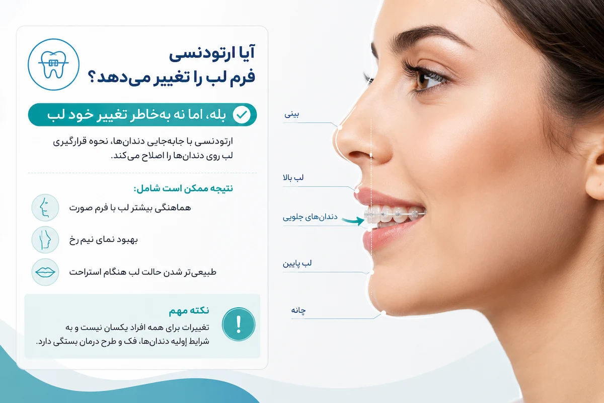 تغییر فرم لب بعد از ارتودنسی