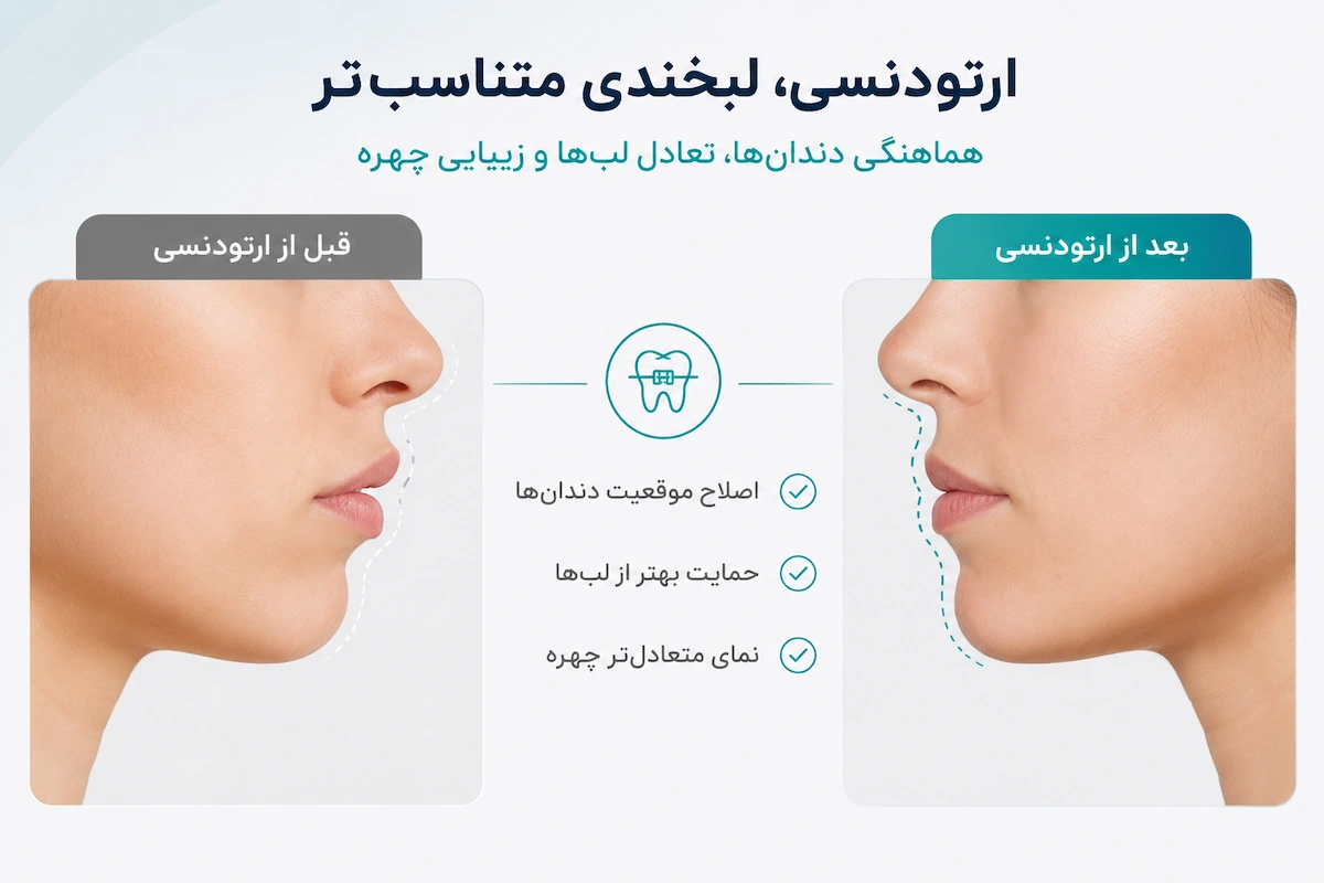 ورم لب بعد از ارتودنسی
