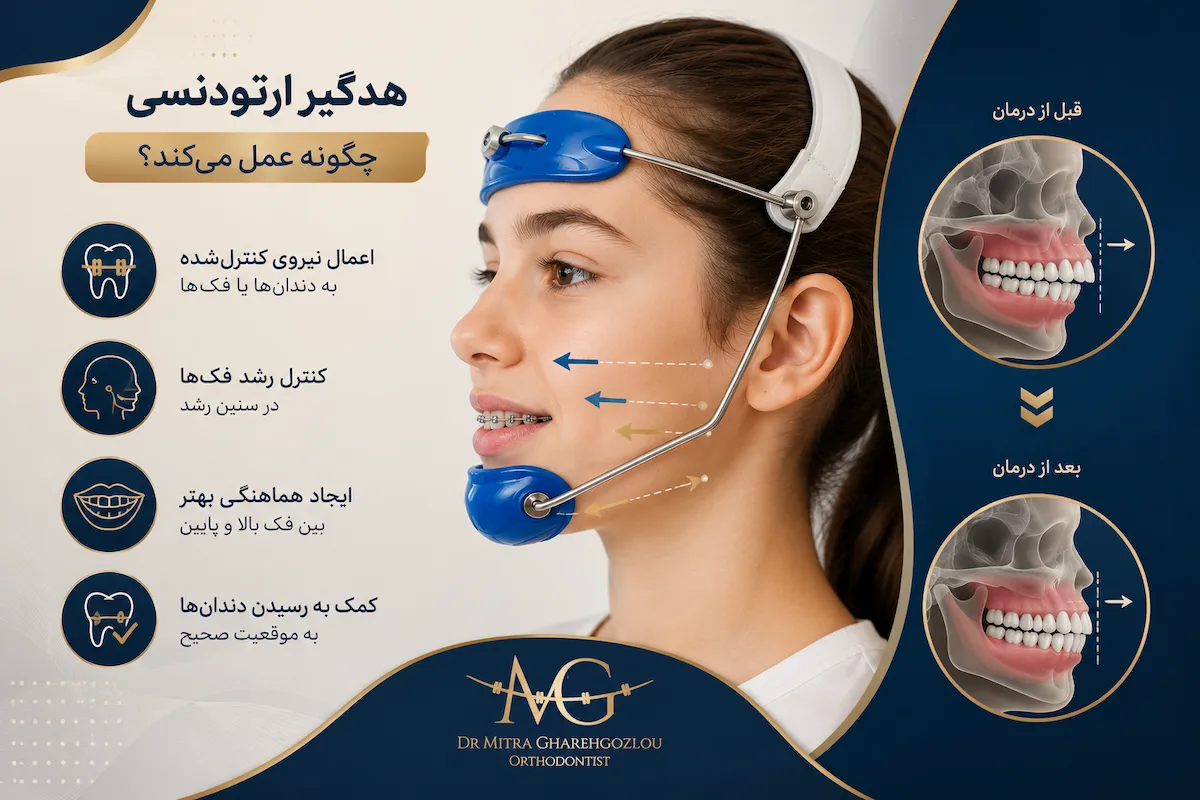 کاربرد هدگیر ارتودنسی
