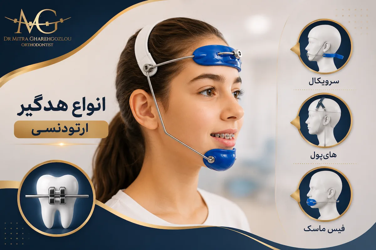 انواع هدگیر ارتودنسی