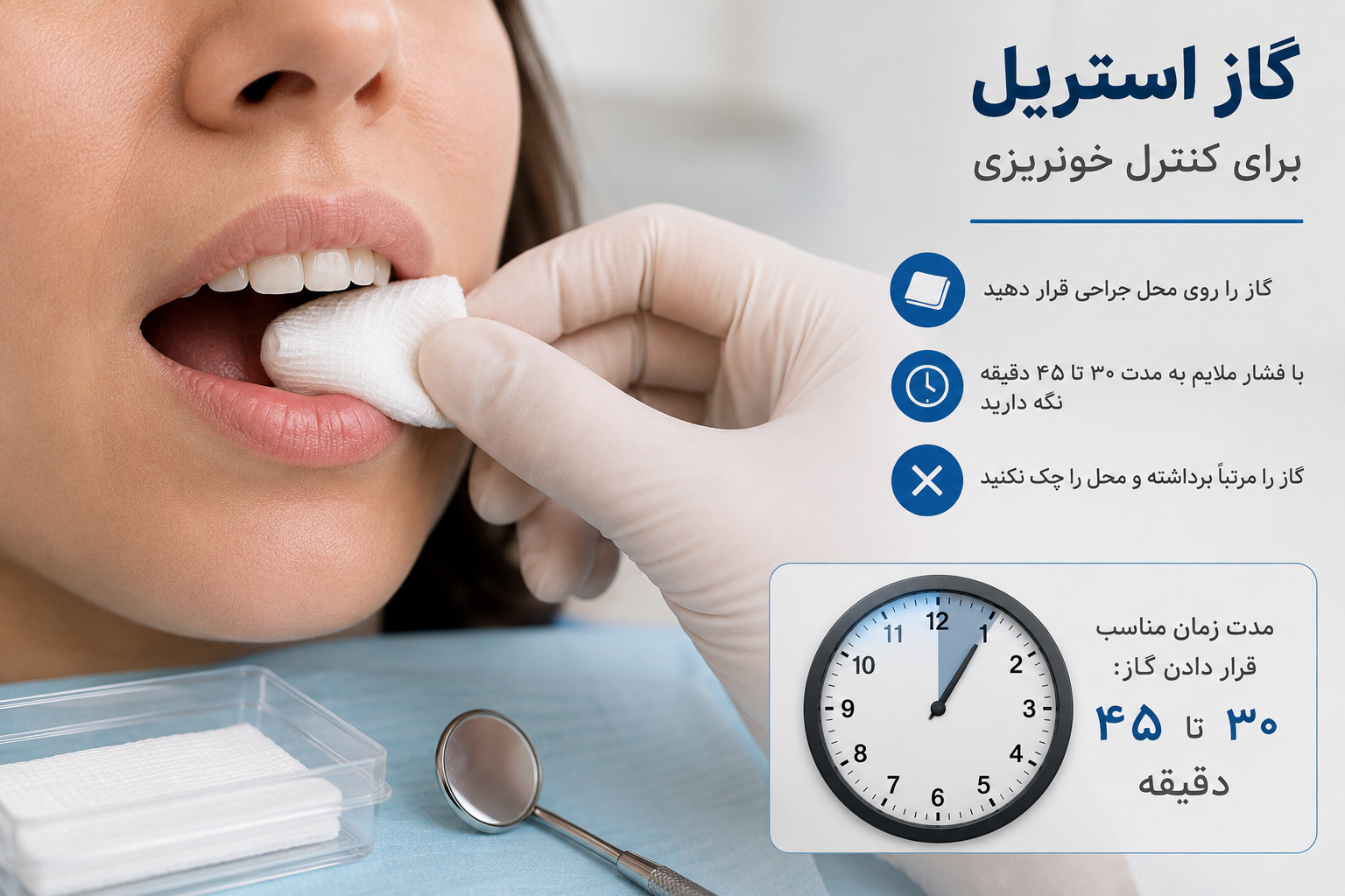 خونریزی بعد از جراحی دندان عقل