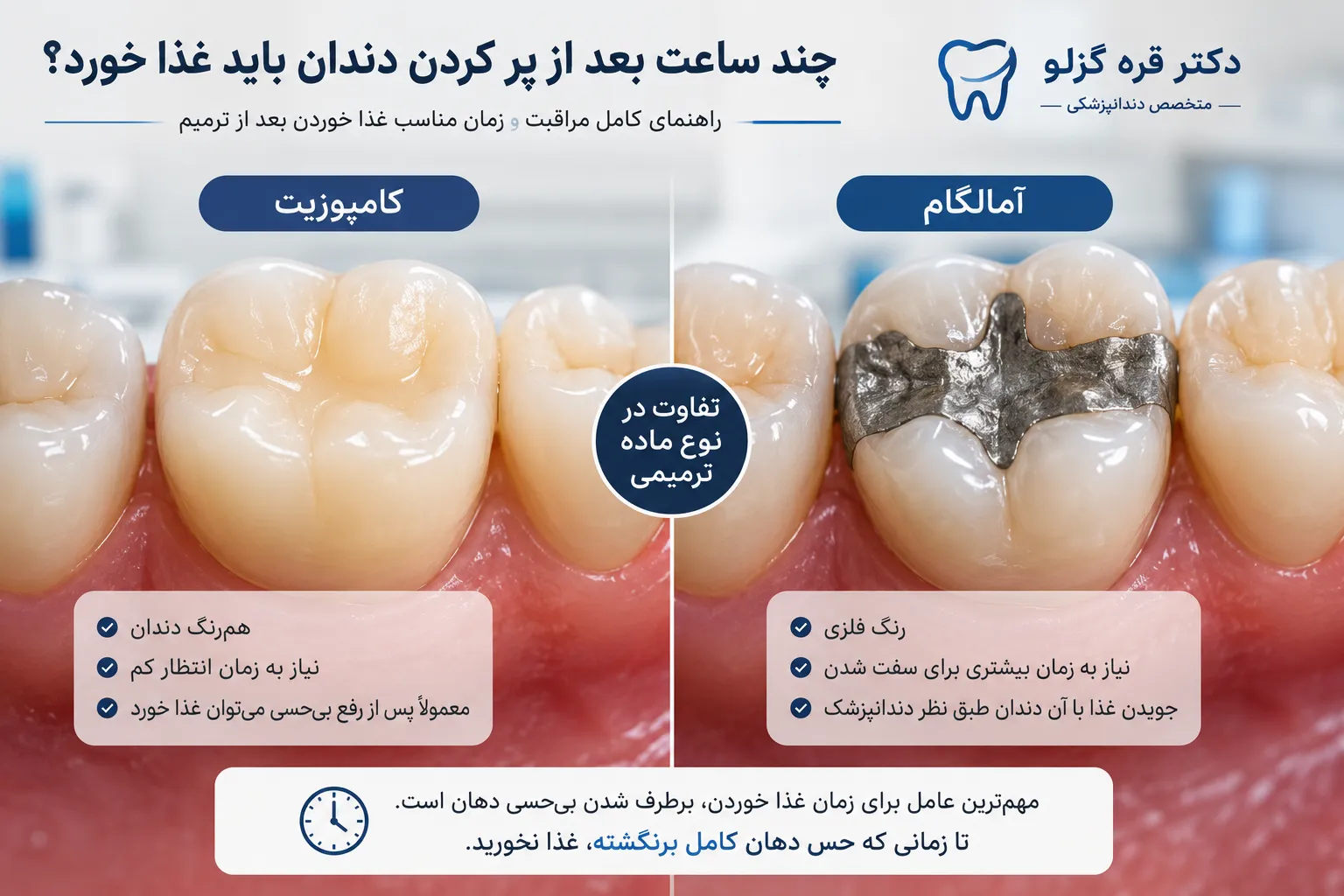 چند ساعت بعد از پر کردن دندان غذا بخورم