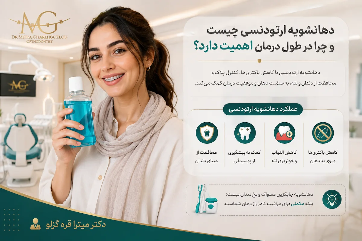 بهترین دهانشویه برای ارتودنسی