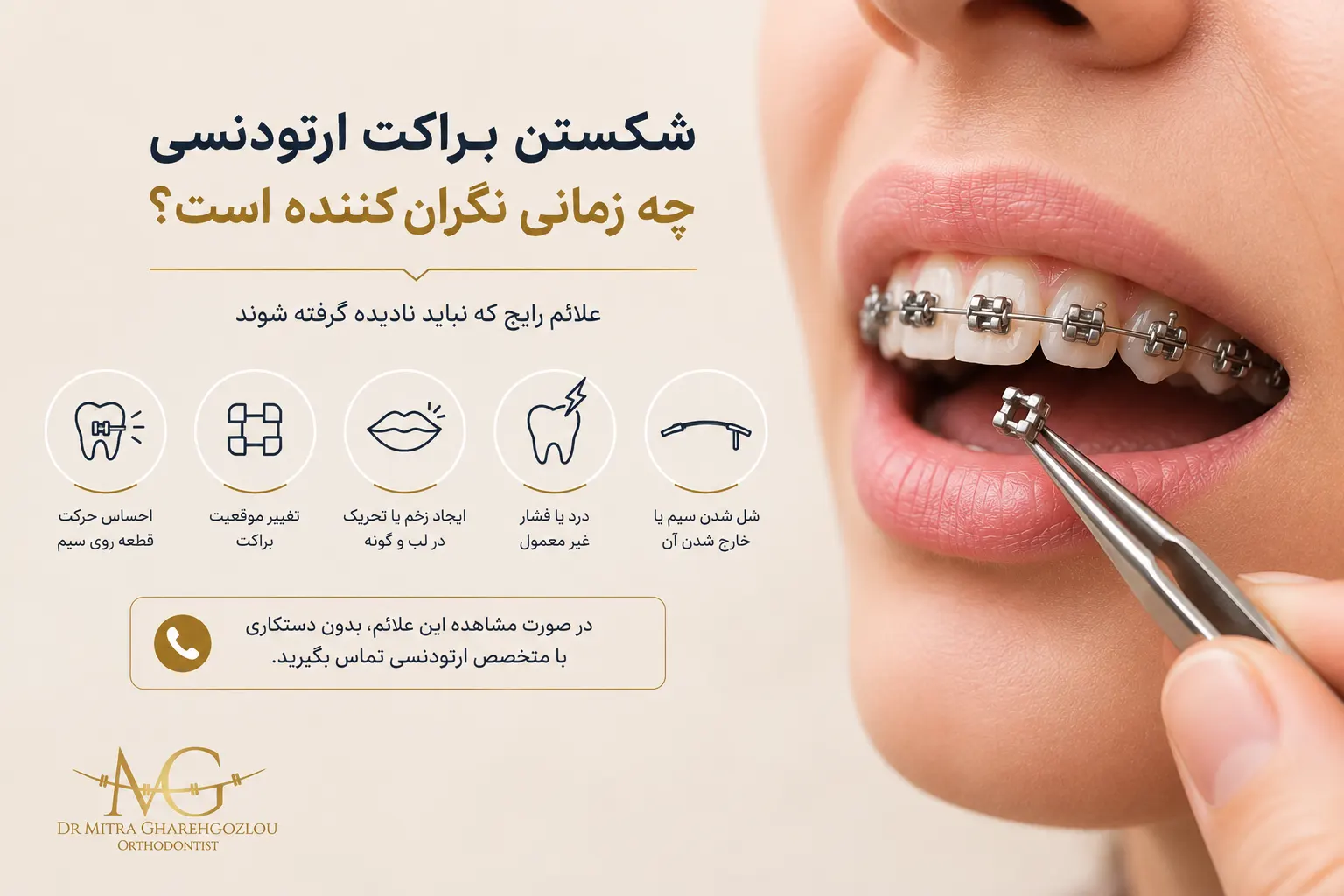 هزینه شکستن براکت ارتودنسی ۱۴۰۵