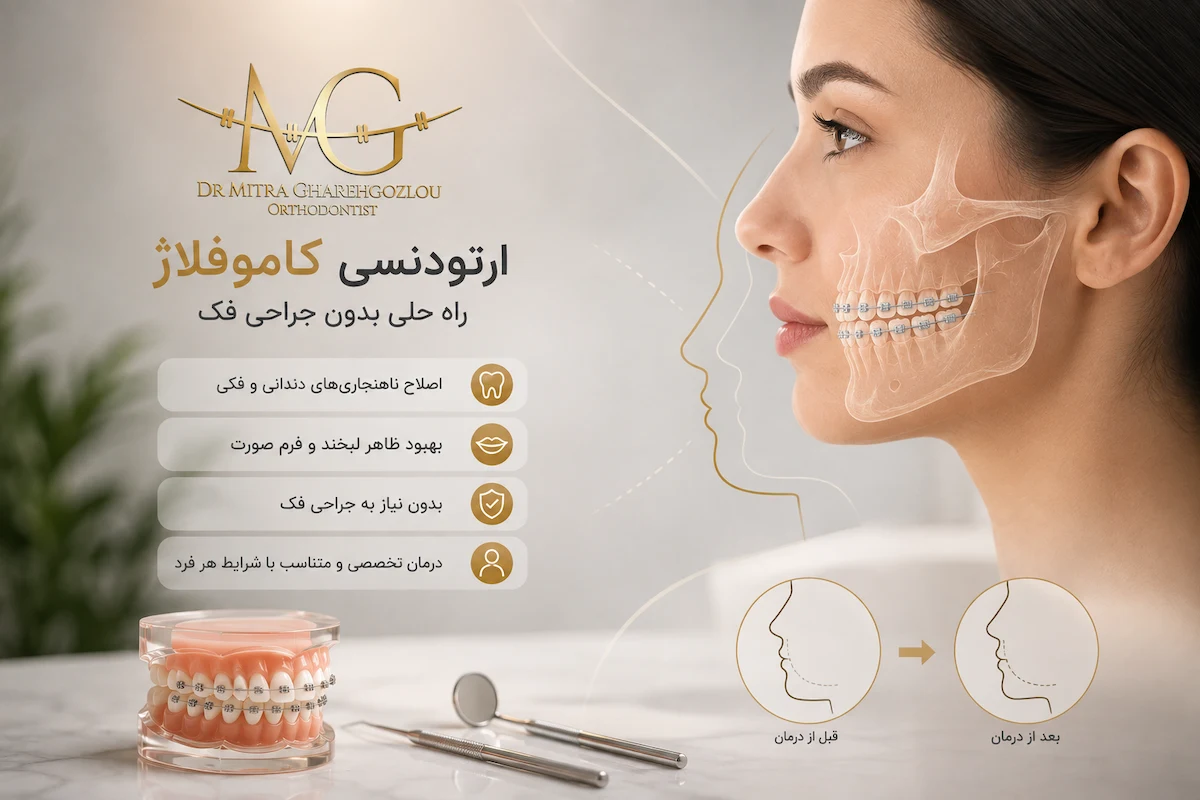 ارتودنسی جبرانی