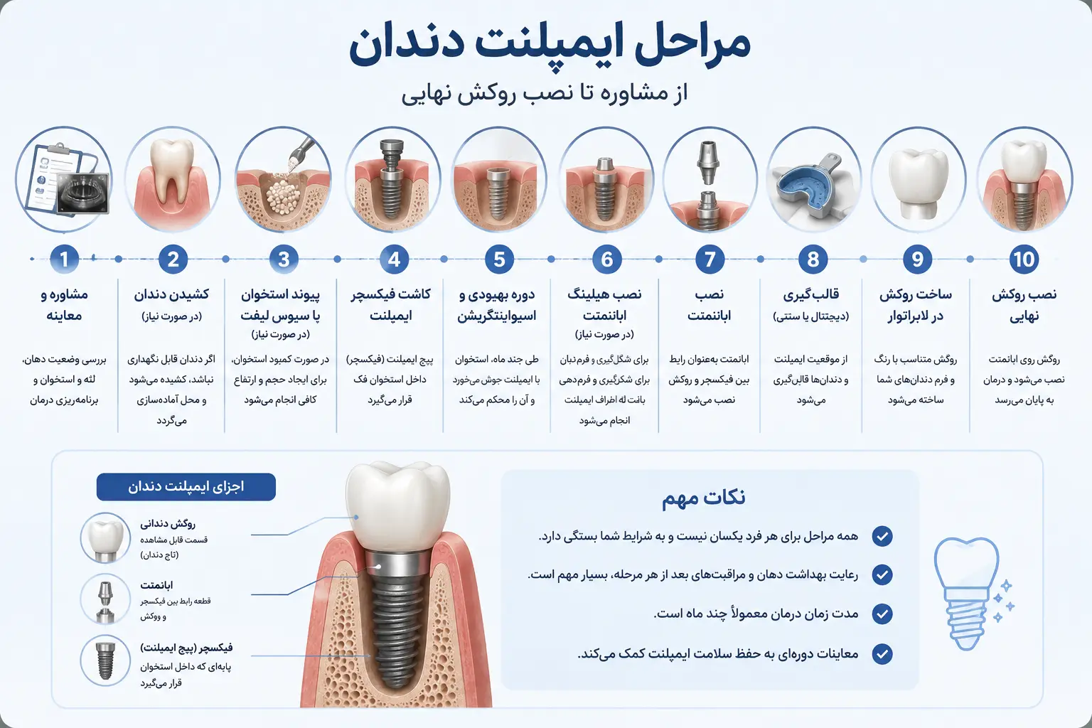 مراحل ایمپلنت دندان به ترتیب