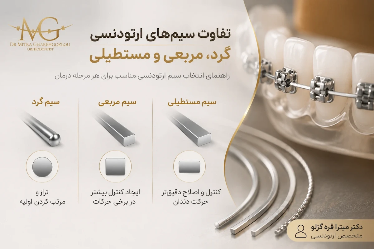 مقایسه شکل مقطع سیم گرد مربعی و مستطیلی ارتودنسی