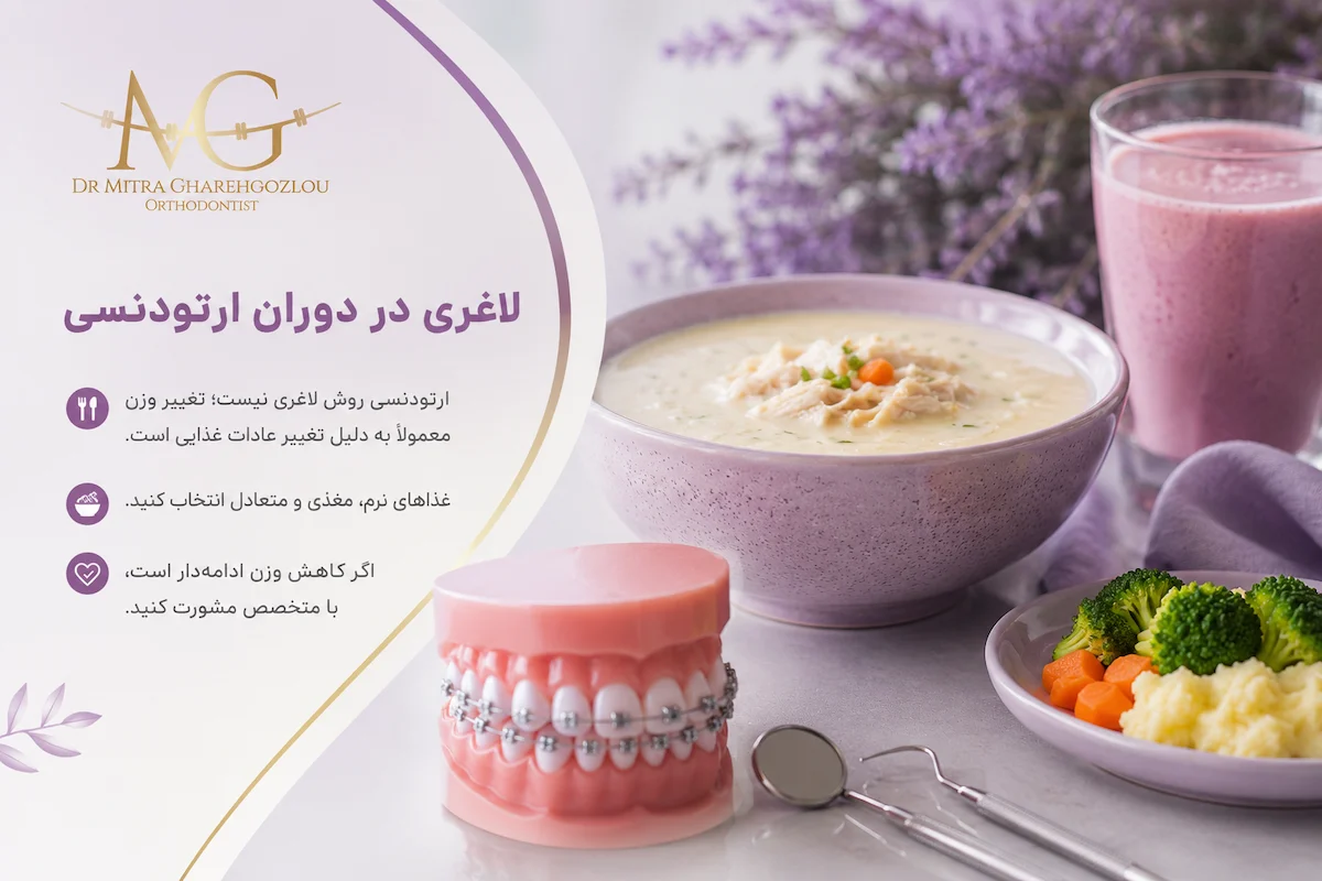 آیا باید برای لاغری در دوران ارتودنسی کالری کمتری مصرف کنیم؟
