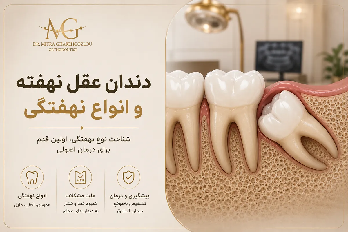دندان عقل نهفته و جهتهای مختلف رویش در فک