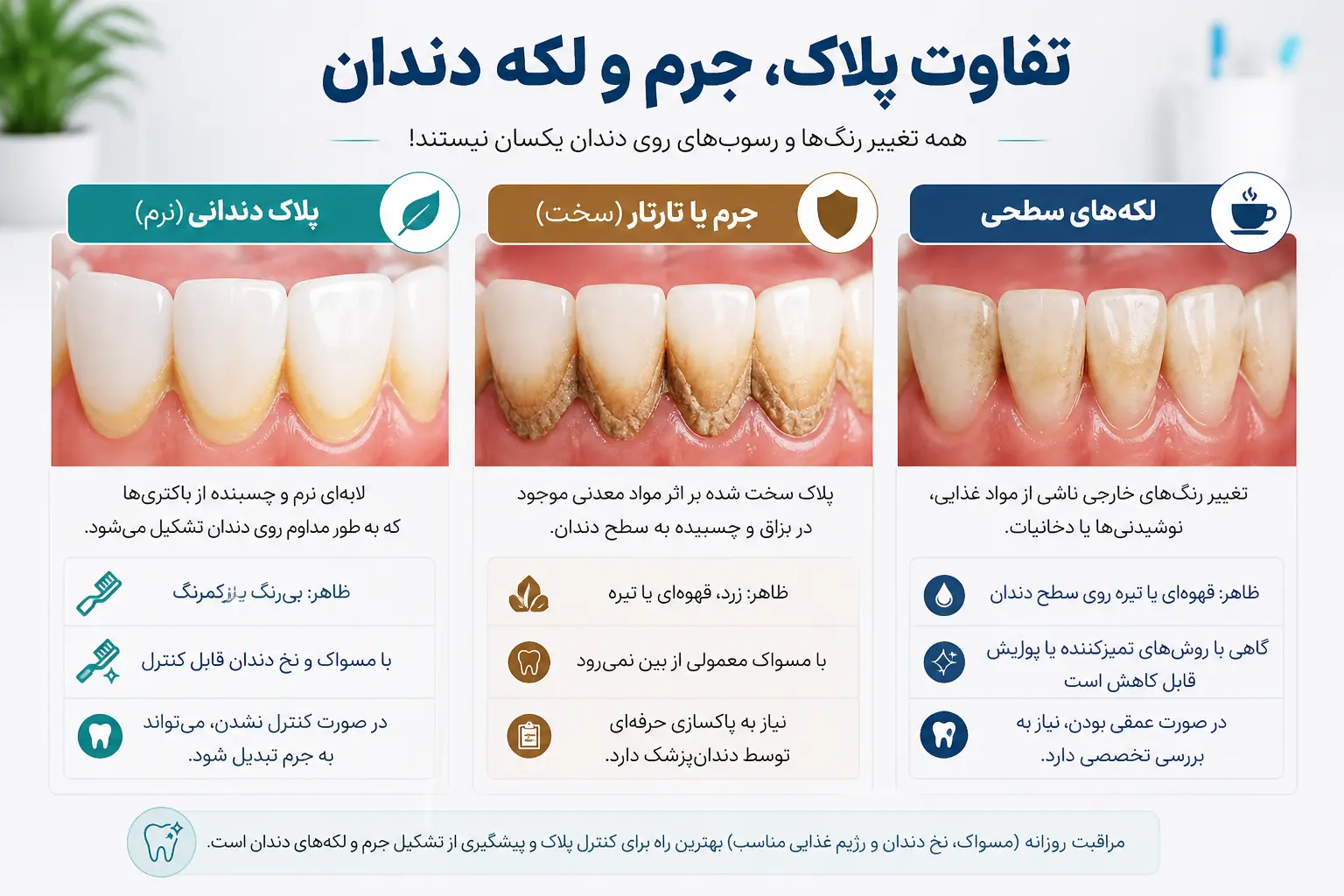 تفاوت پلاک جرم لکه دندان