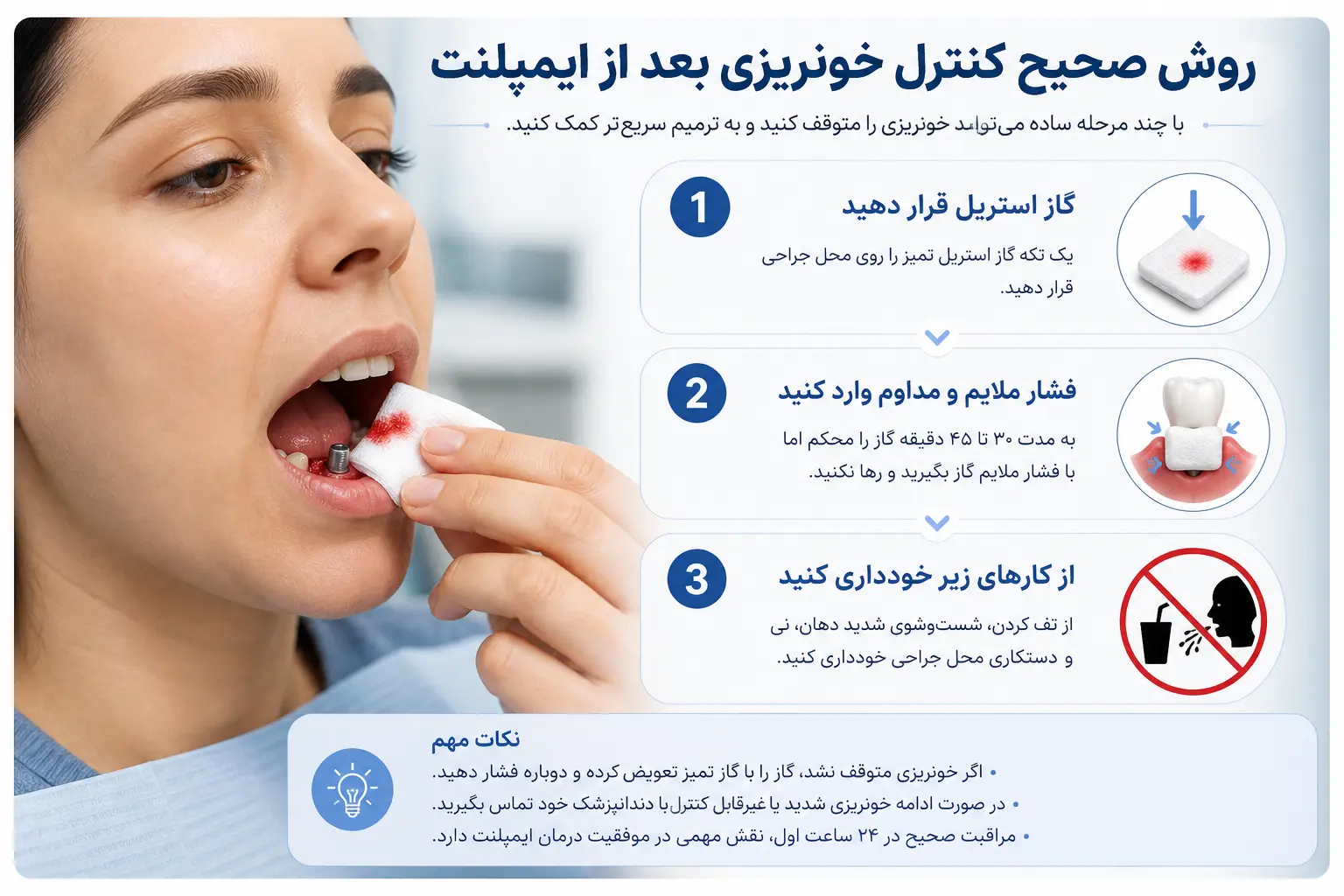 روش صحیح کنترل خونریزی بعد از ایمپلنت