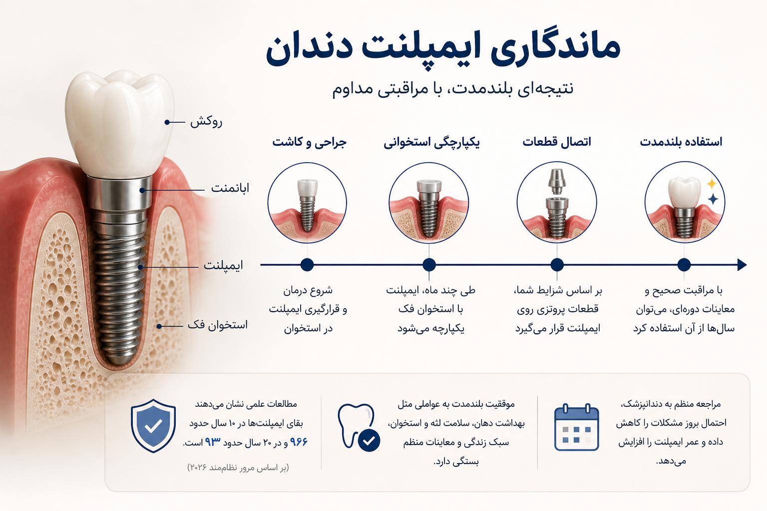 ماندگاری ایمپلنت دندان