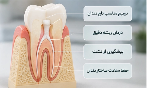 مراحل درمان سیاهی دندان عصب کشی شده