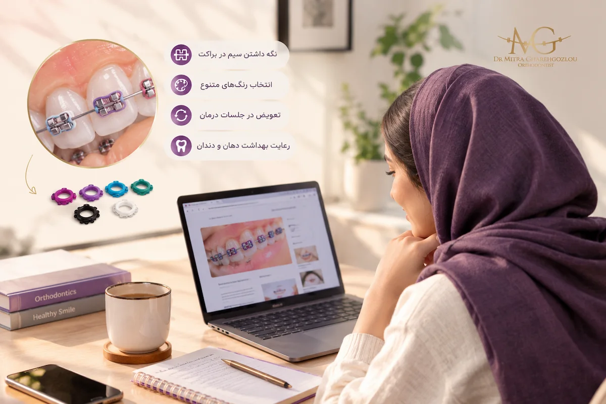 درآمدن اورینگ ارتودنسی